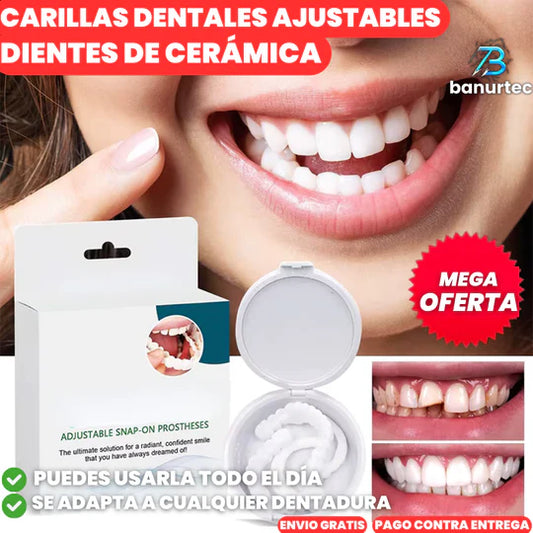 Carillas Dentales Snap On Smile🦷 | Luce una Sonrisa Soñada