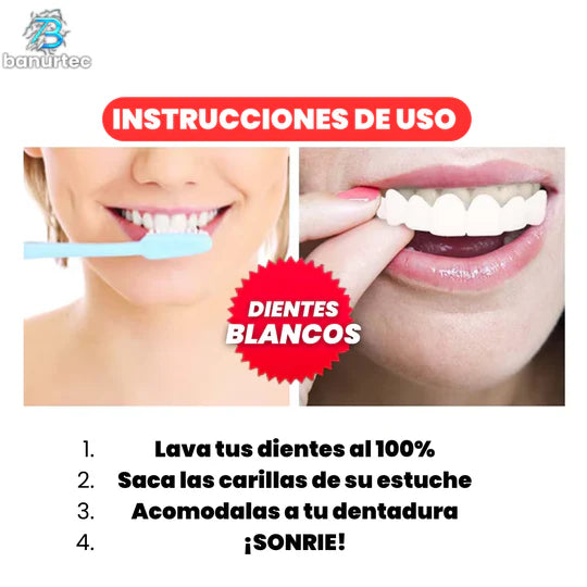 Carillas Dentales Snap On Smile🦷 | Luce una Sonrisa Soñada